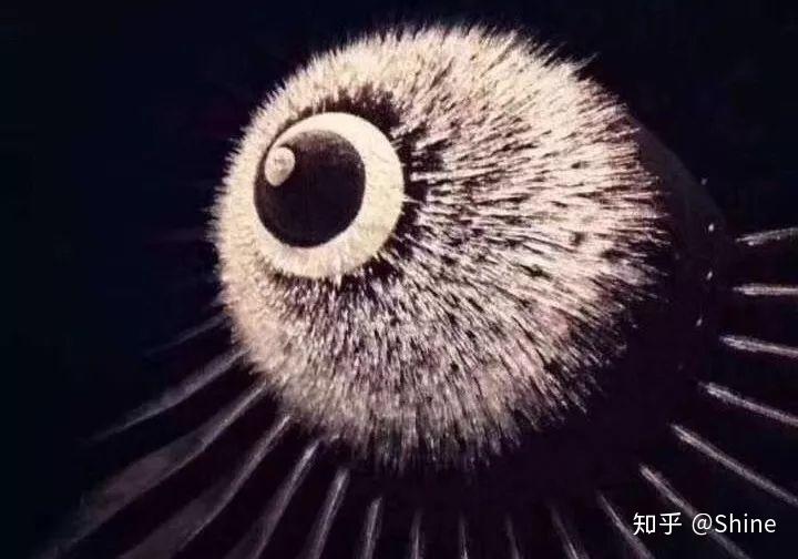 严谨的术前检查为屈光手术保驾护航